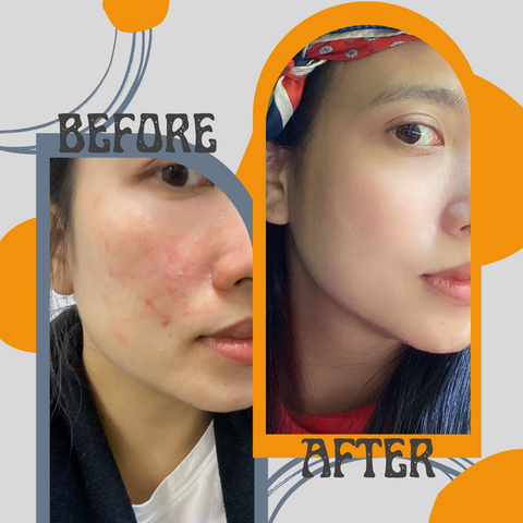 sensitive skin compare before and after