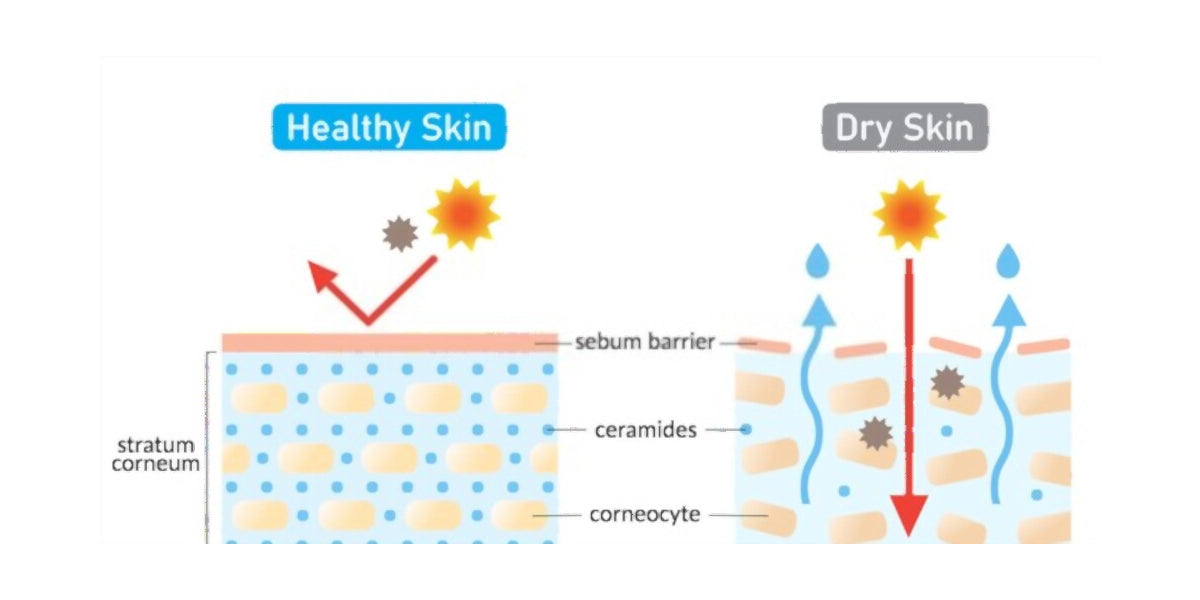 What Can Lack of Natural Ceramides in Skincare?