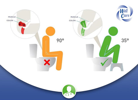 Warum können Sie mithilfe des physiologische Toilettenhockers die natürliche Position auf der Toiletten einnehmen?