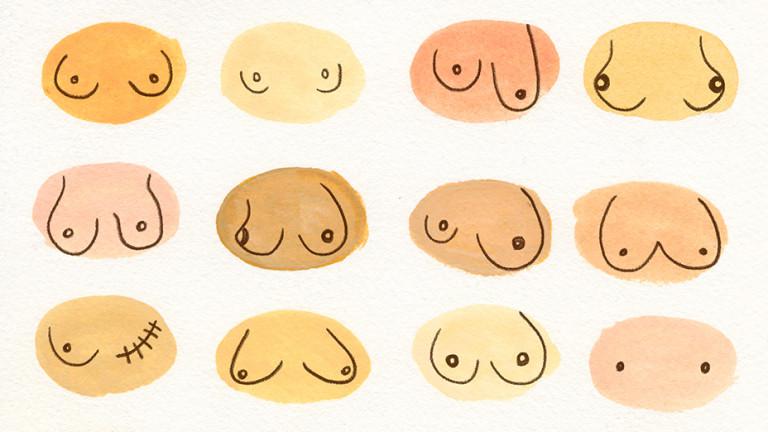 breast morphologies and shapes