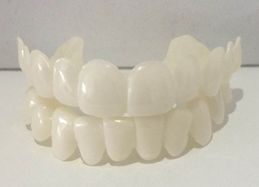 Lumineers, Snap On Smile Veneers, Temporary Veneers, Snap On Teeth