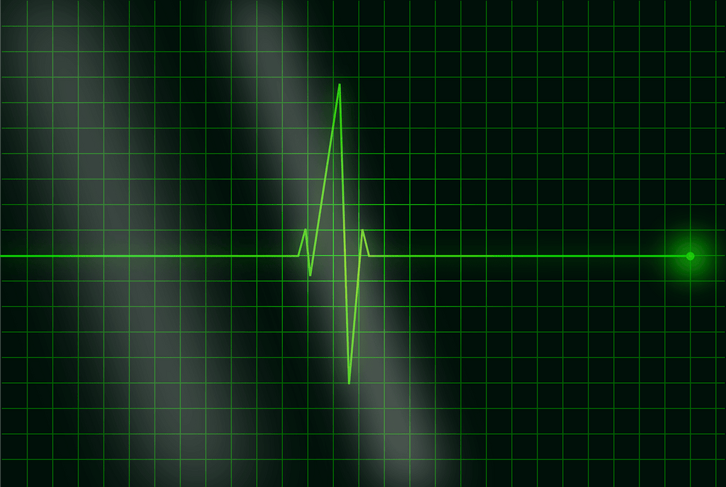 electro cardiogramme