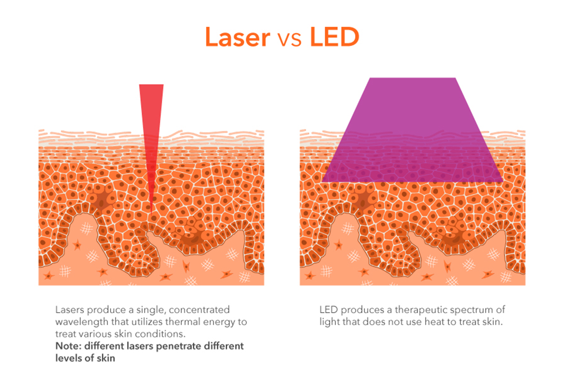 See the difference between laser and LED treatments