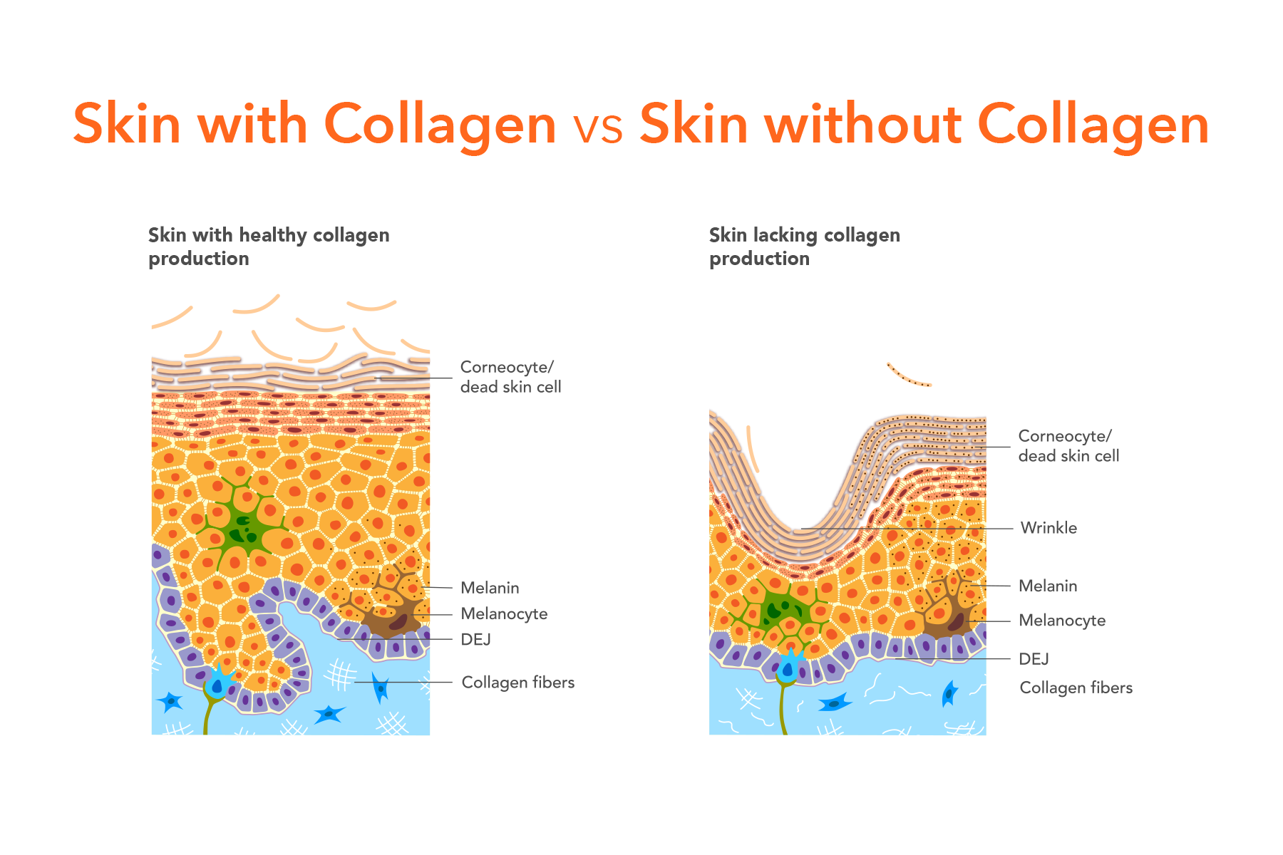 Skin with and without collagen comparison graphic.