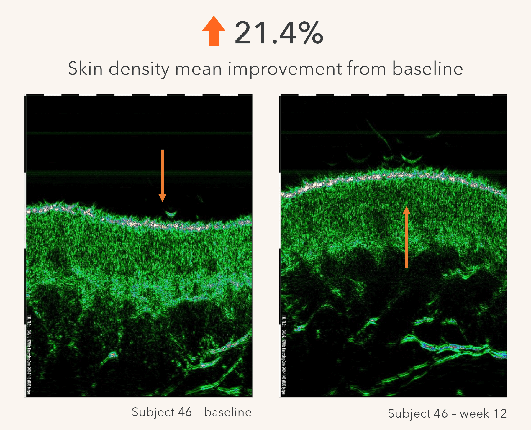 Skin density improvement graphic