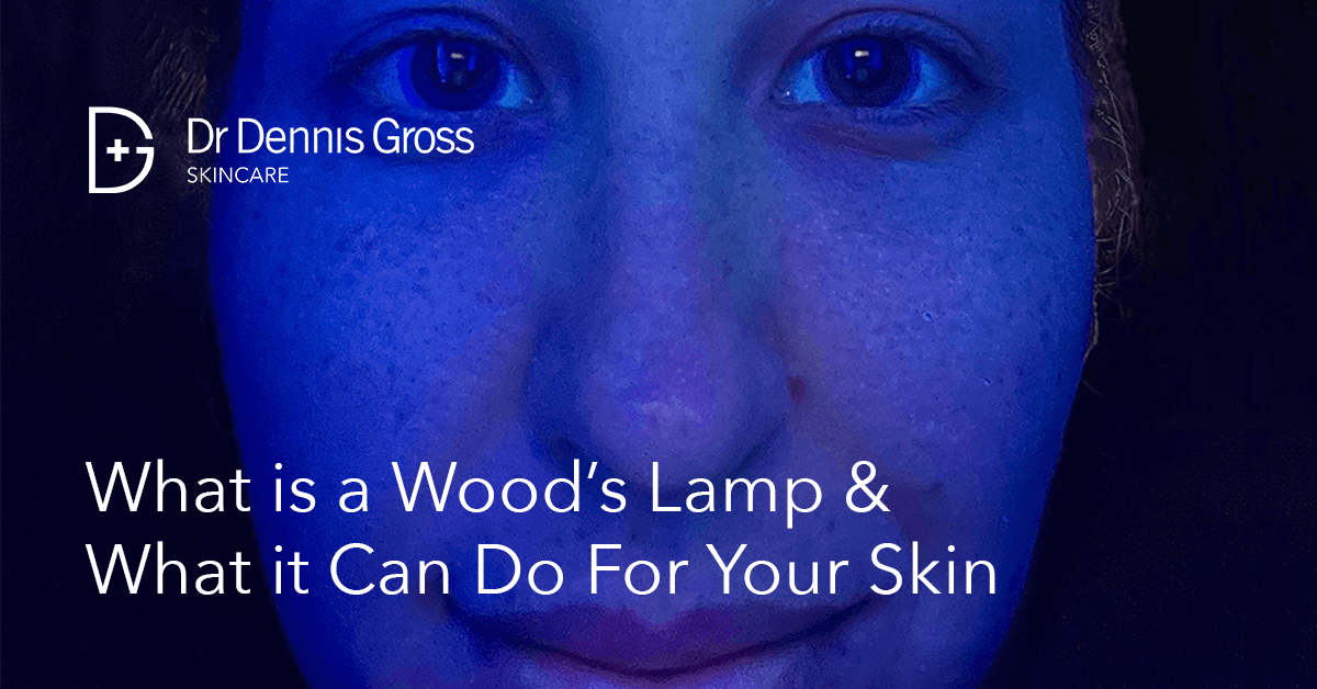 Lámpara de Wood: qué es, para qué sirve y cómo funciona - Tua Saúde
