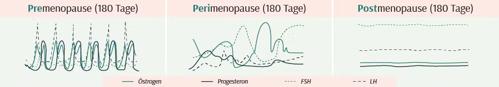 Pre-, Peri- und Postmenopause Grafiken