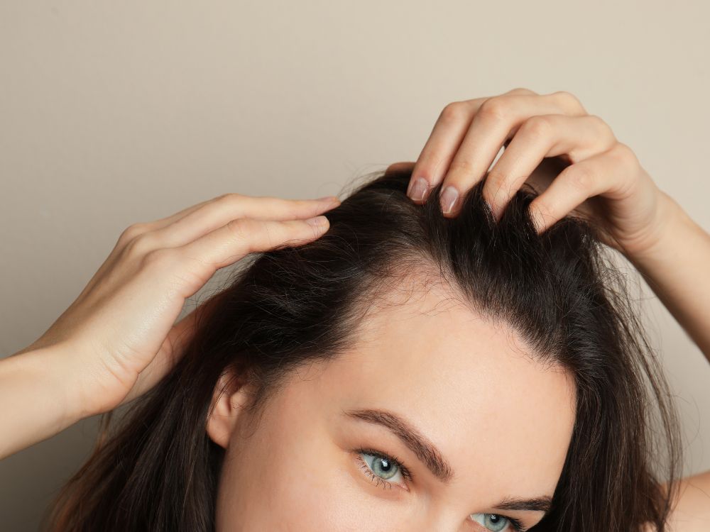 ما هو بديل زراعة الشعر ؟