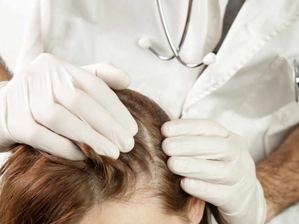 ما هي اكزيما الشعر