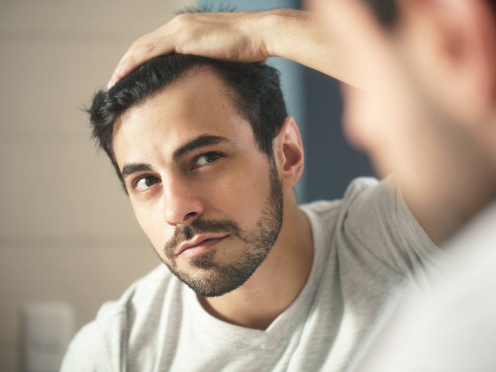 ماهي أسباب تساقط الشعر عند الشباب؟