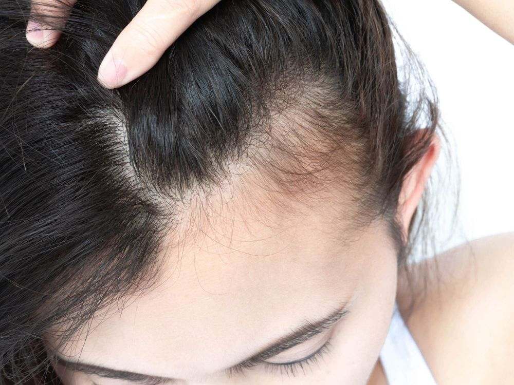 علاج الشعر الخفيف والمتساقط للنساء