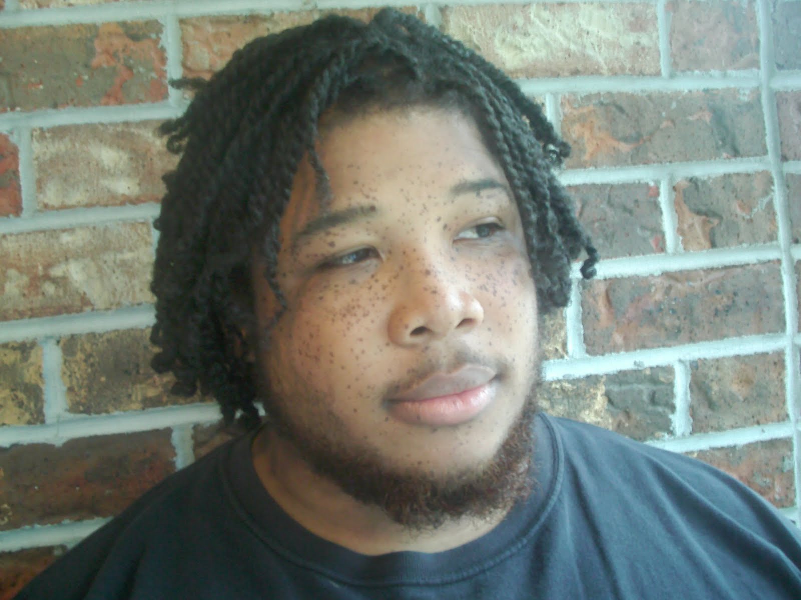 freckled man with mid-face length twisted dreadlocks looking away from the camera in front of a brick wall