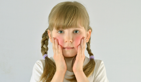 Child With Itchy Skin Red Cheeks 