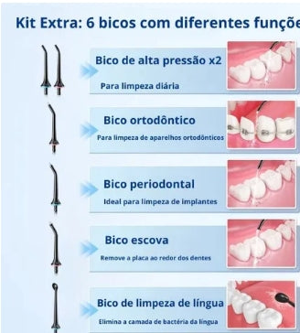 Irrigador Oral Portátil Bivolt - Water Clean