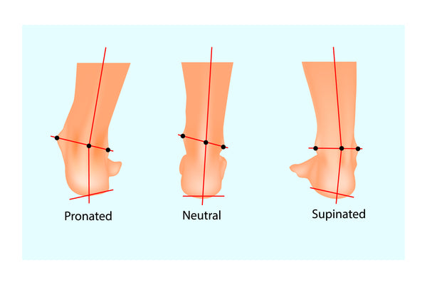Illustration of normal human foot and the foot with pronation and supination