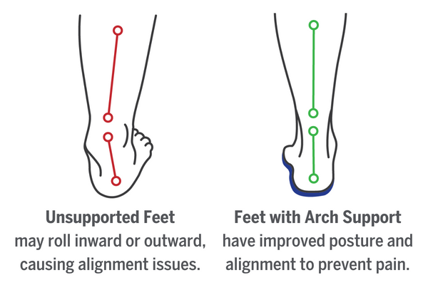 Comparing unsupported feet versus feet with arch support