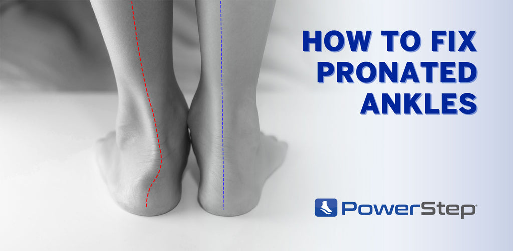 Discover the Right Orthotics to Solve Your Supination