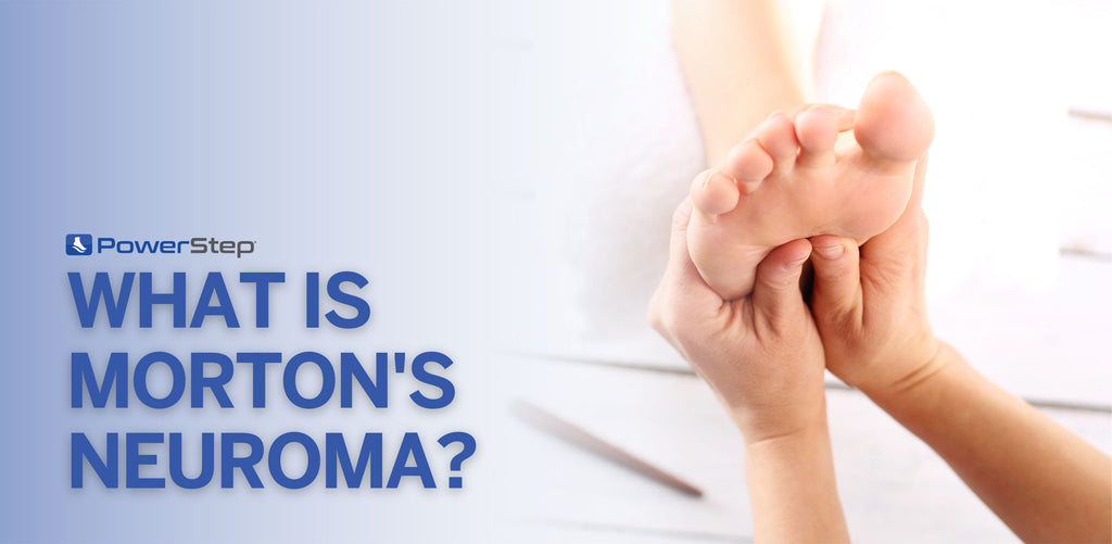 Morton’s Neuroma: An Overview – PowerStep