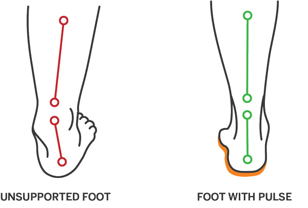 Illustration of an unsupported foot and ankle vs a foot supported using PULSE