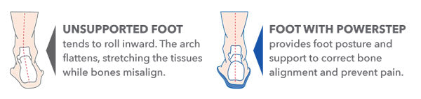 illustration of an unsupported foot vs a foot supported with PowerStep insoles