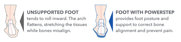 Illustration of an unsupported foot versus a foot supported by PowerStep insoles