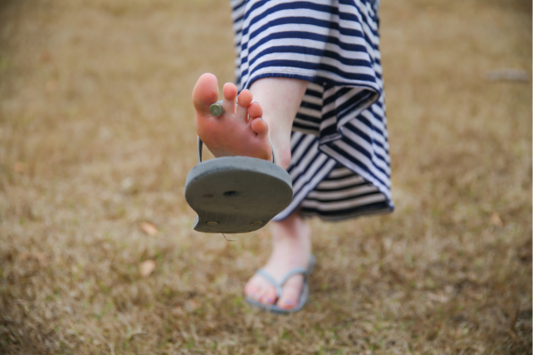 Woman wearing flip flop with broken toe post