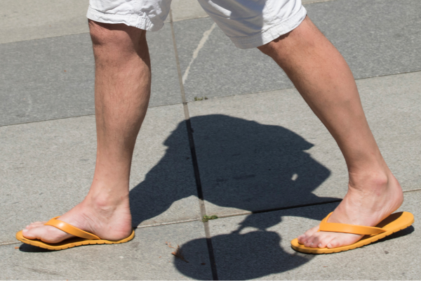 Man walking on street in flip flops with no support