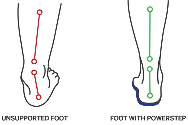 Illustration of an unsupported foot and a foot supported with PowerStep orthotics