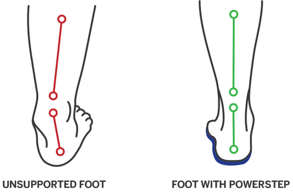 Bunions – PowerStep