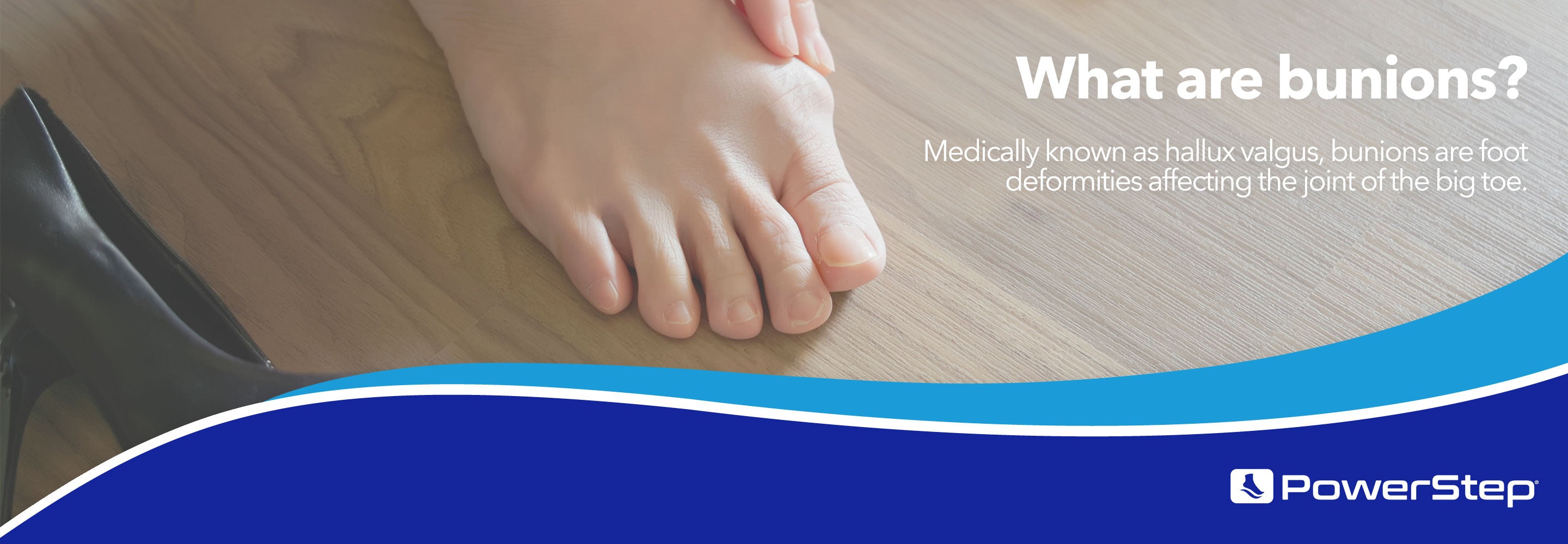 What are bunions? Medically known as hallux valgus, bunions are foot deformities affecting the joint of the big toe.