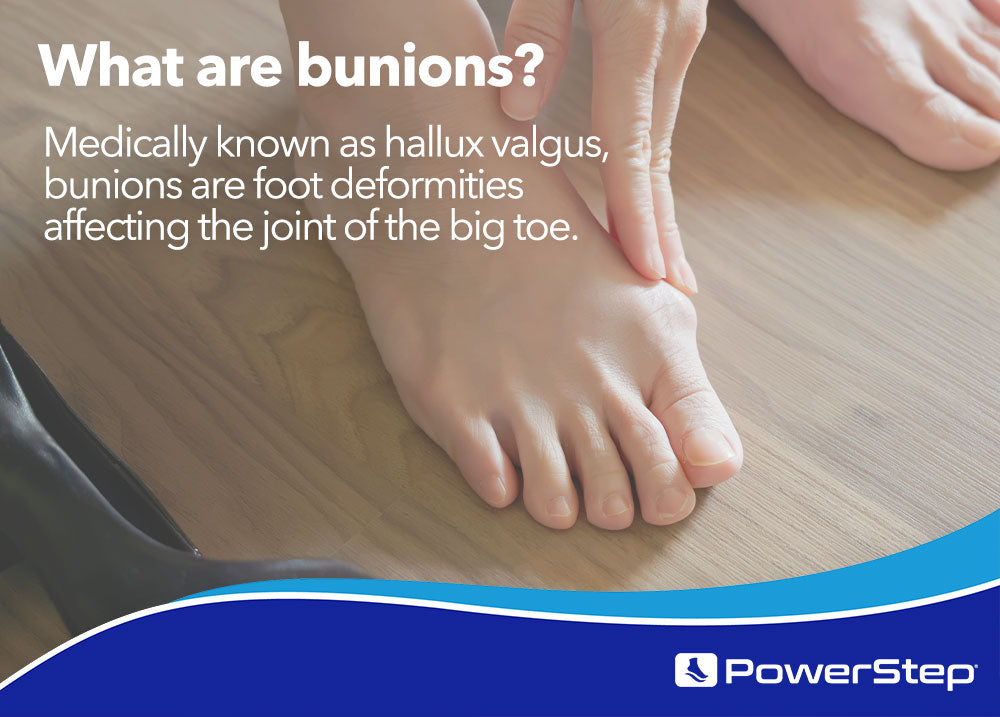 What are bunions? Medically known as hallux valgus, bunions are foot deformities affecting the joint of the big toe.