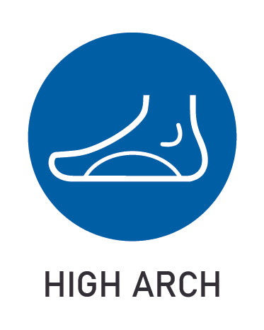 high arch