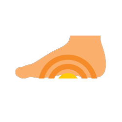 Low arch, flat feet, arch support insert for overpronation, arch support insert for pronation