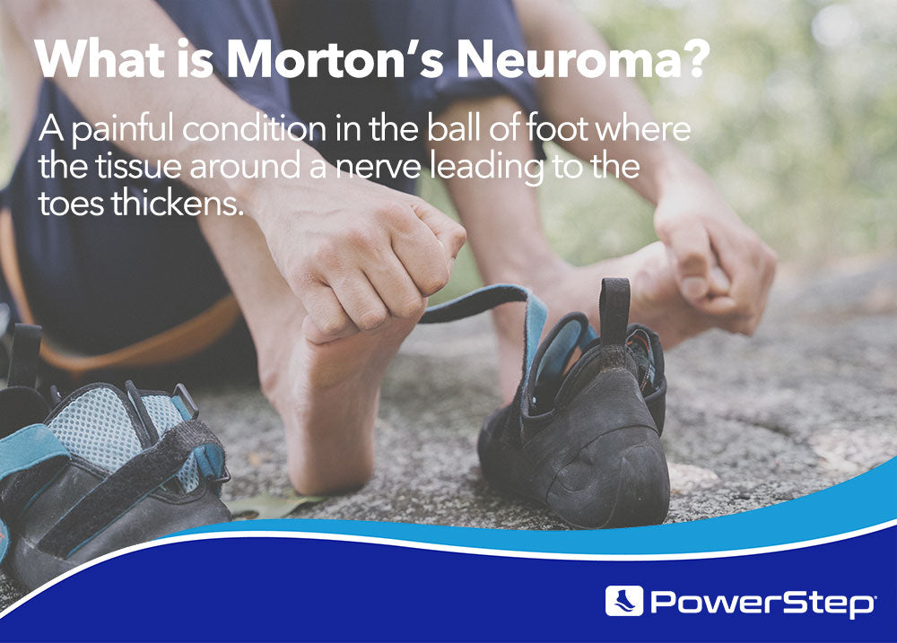 What is Morton's Neuroma? A painful condition in the ball of foot where the tissue around a nerve ending leading to the toes thickens.