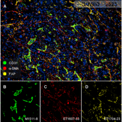 Human pancreatic carcinoma tissue CD31 (M1511-8, green), α-SMA (ET1607-53, red) , FAP (ET1704-23, yellow)