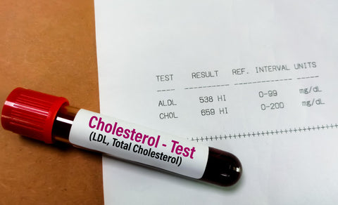 Omega 3 colesterol
