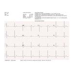 Welch Allyn/Mortara ELI230 ECG with standard patient cable (1)