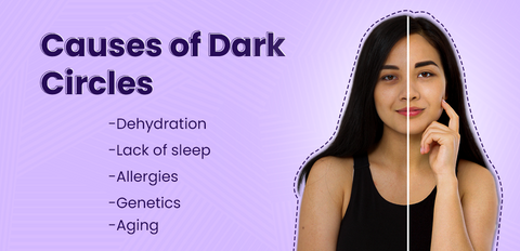 Causes of Dark circles