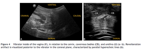 Ultrasound of Vibrator Inside Vagina