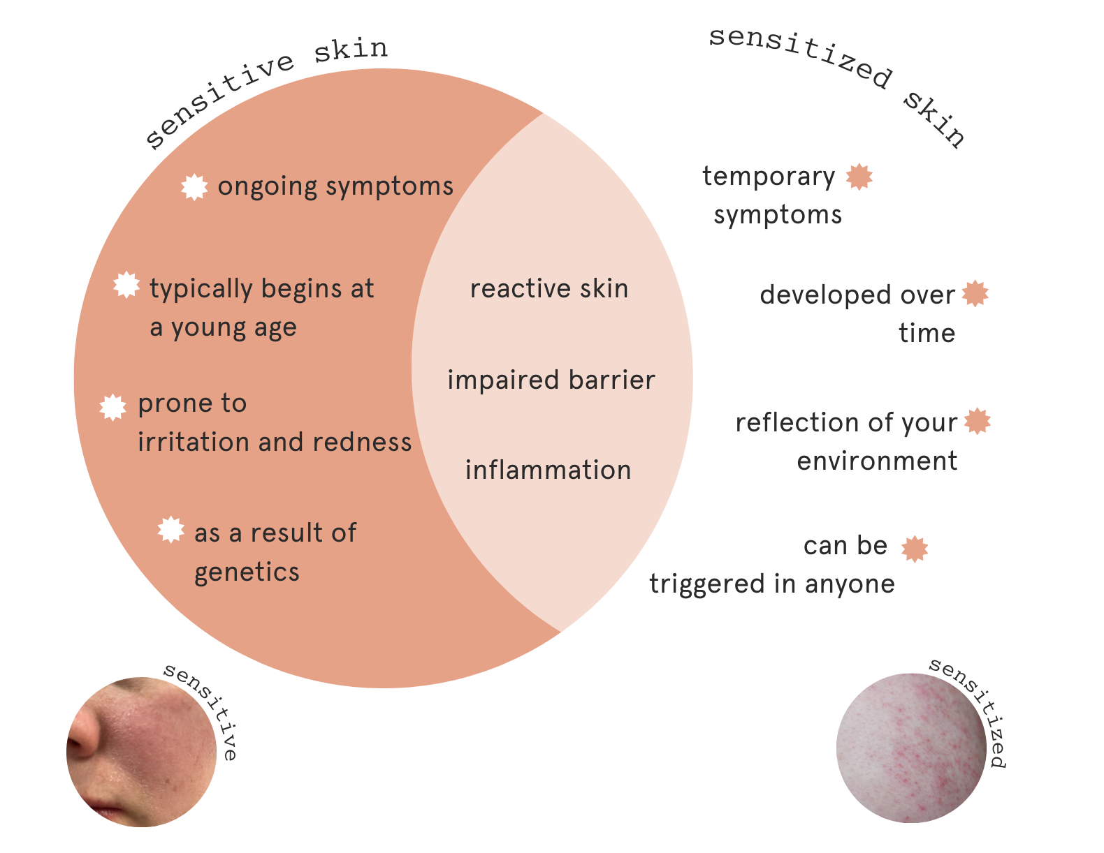 Infographic on Sensitive versus Sensitized Skin