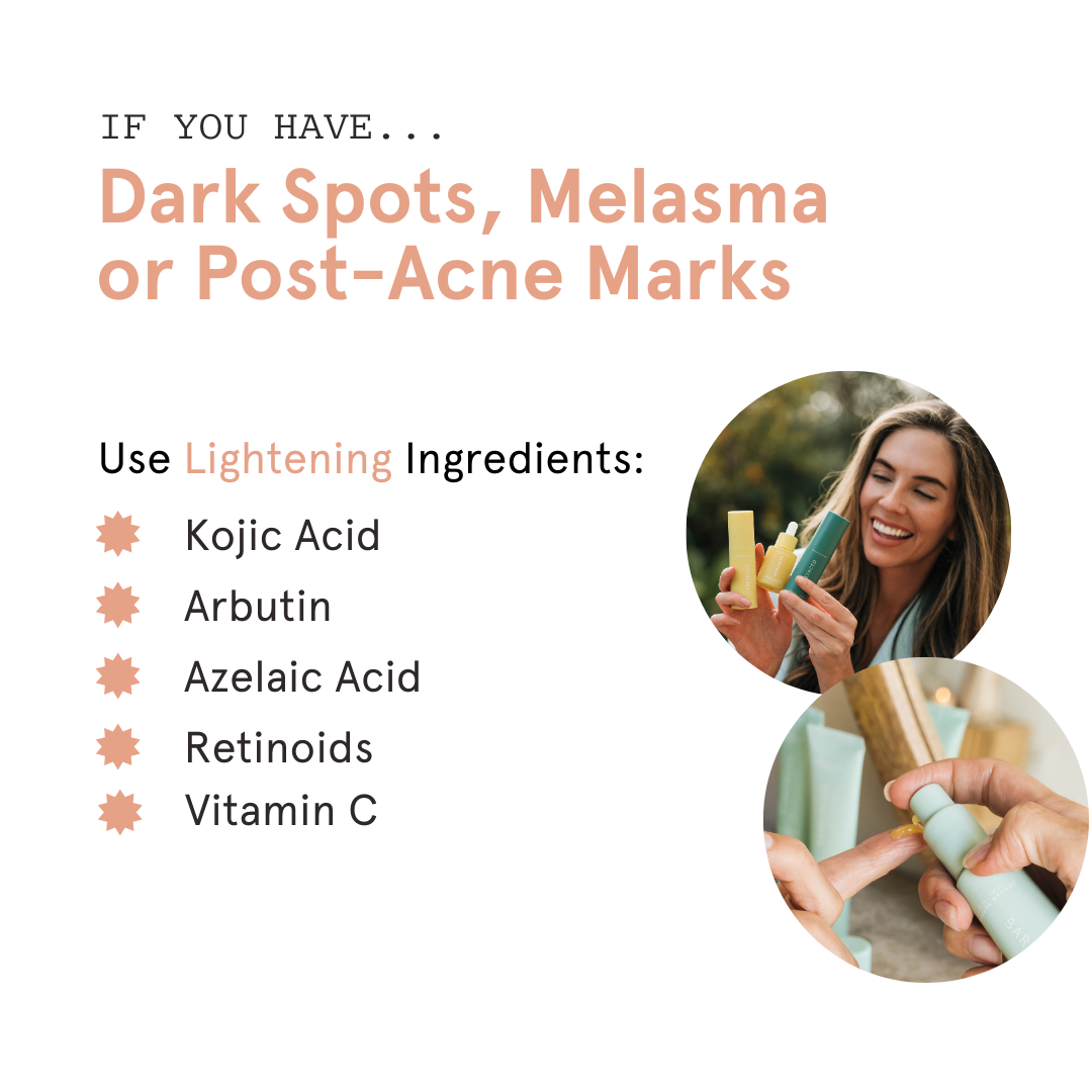 If you have dark spots infographic