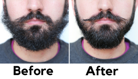 Before and After Picture of Men's Hair and Beard Growth Oil