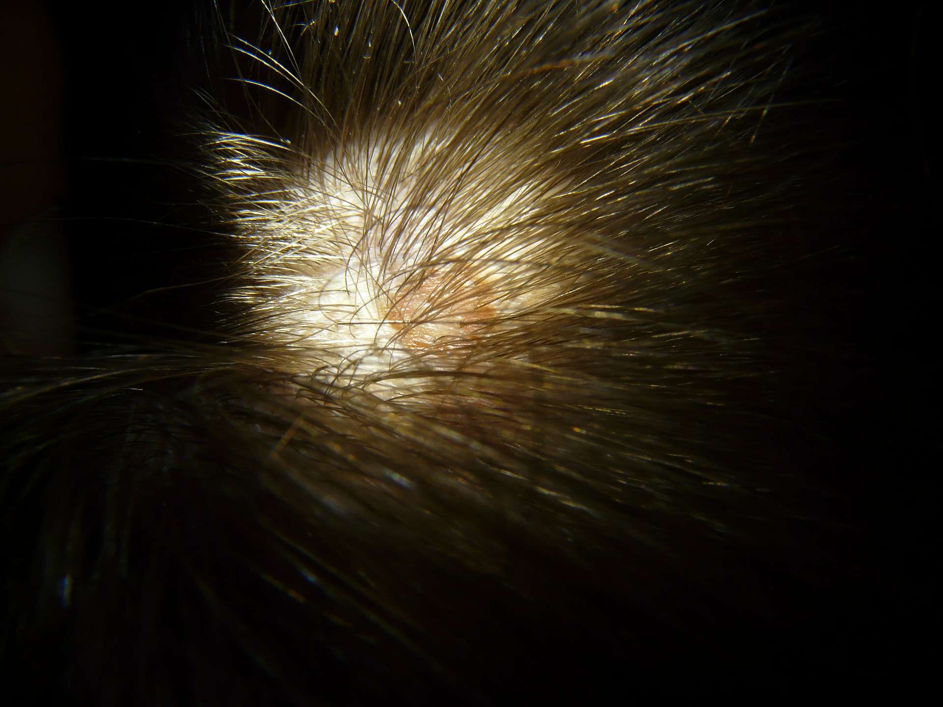 A patch of dry skin on someone’s scalp, surrounded by dark brown hair.