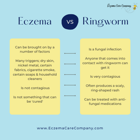 eczema versus ringworm