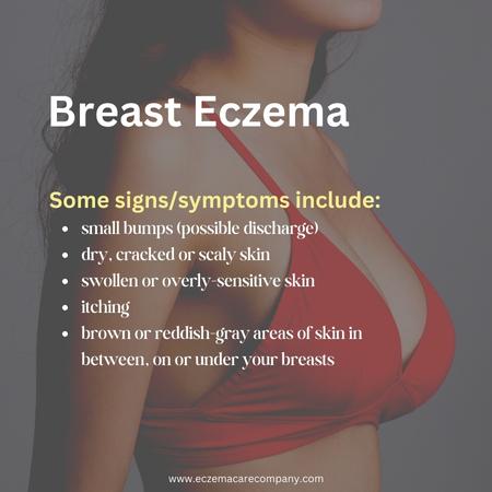 Breast Eczema - What to Know Eczema Care Company