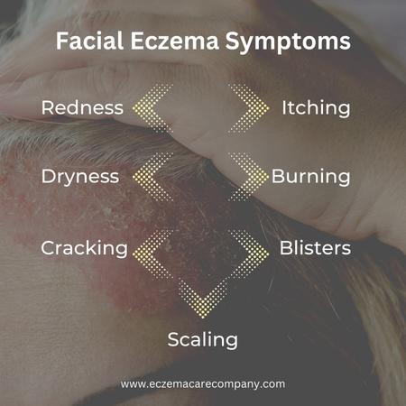 facial-eczema-symptoms