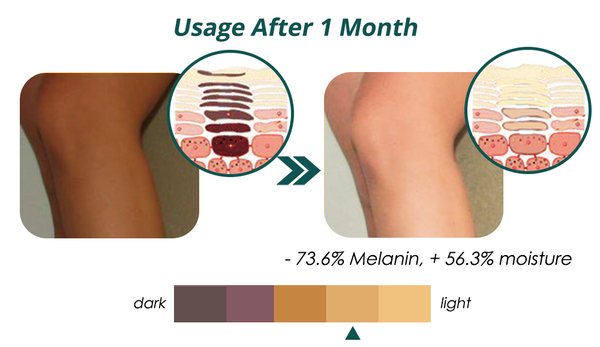 flysmus™ Seidenprotein-Melanin-Bleichseife