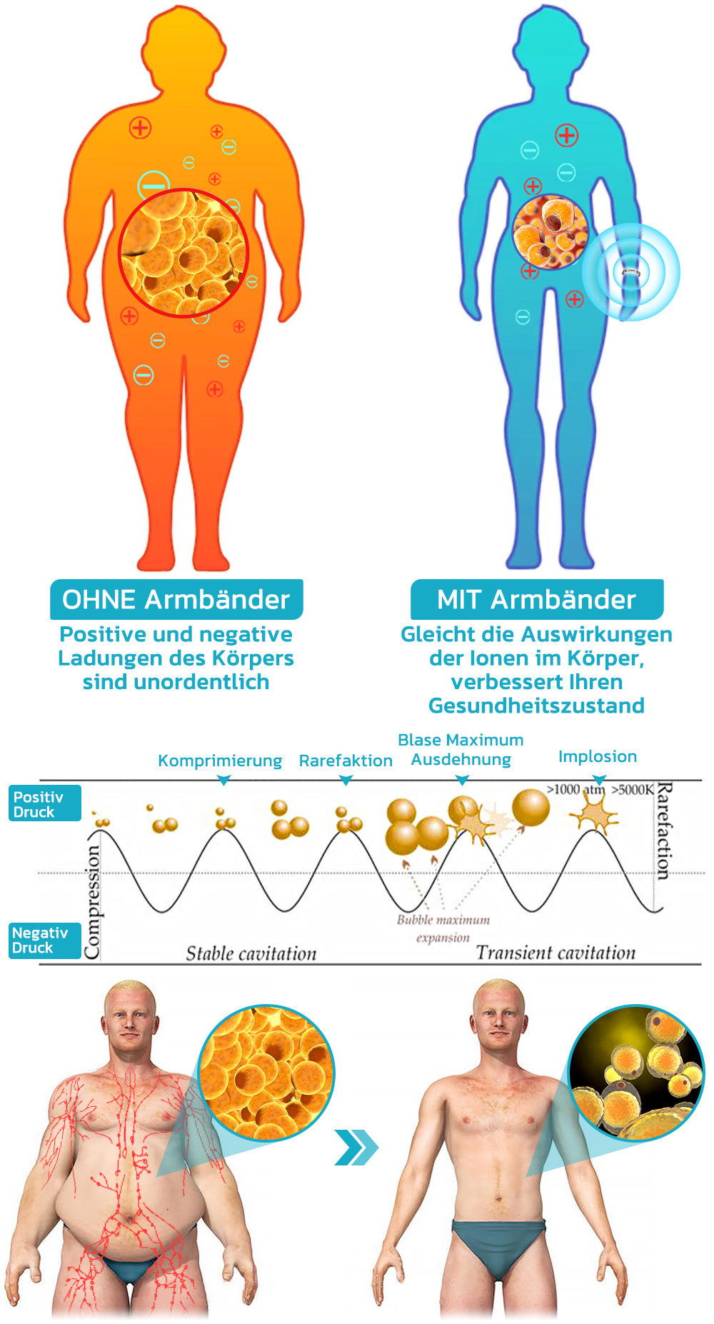 GFOUK™ SuperTitani Germanium Lymphgefäß-aproce