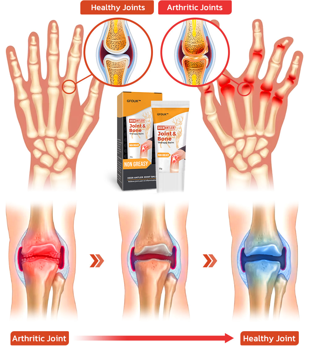 GFOUK™ DeerAntler Joint and Bone Therapy Balm 