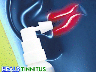 GFOUK™ Anti Tinnitus Earwax Removal Spray 